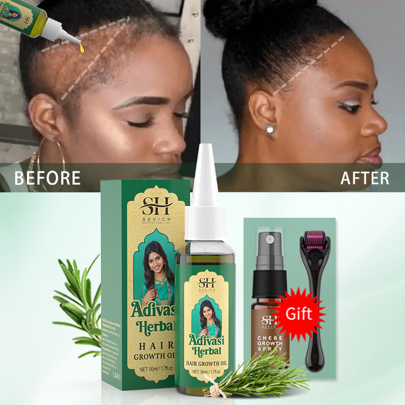 アーユルヴェーダヘアグロースオイル インドアディヴァシハーブ - Biotin Hair Growth のレビューと価格