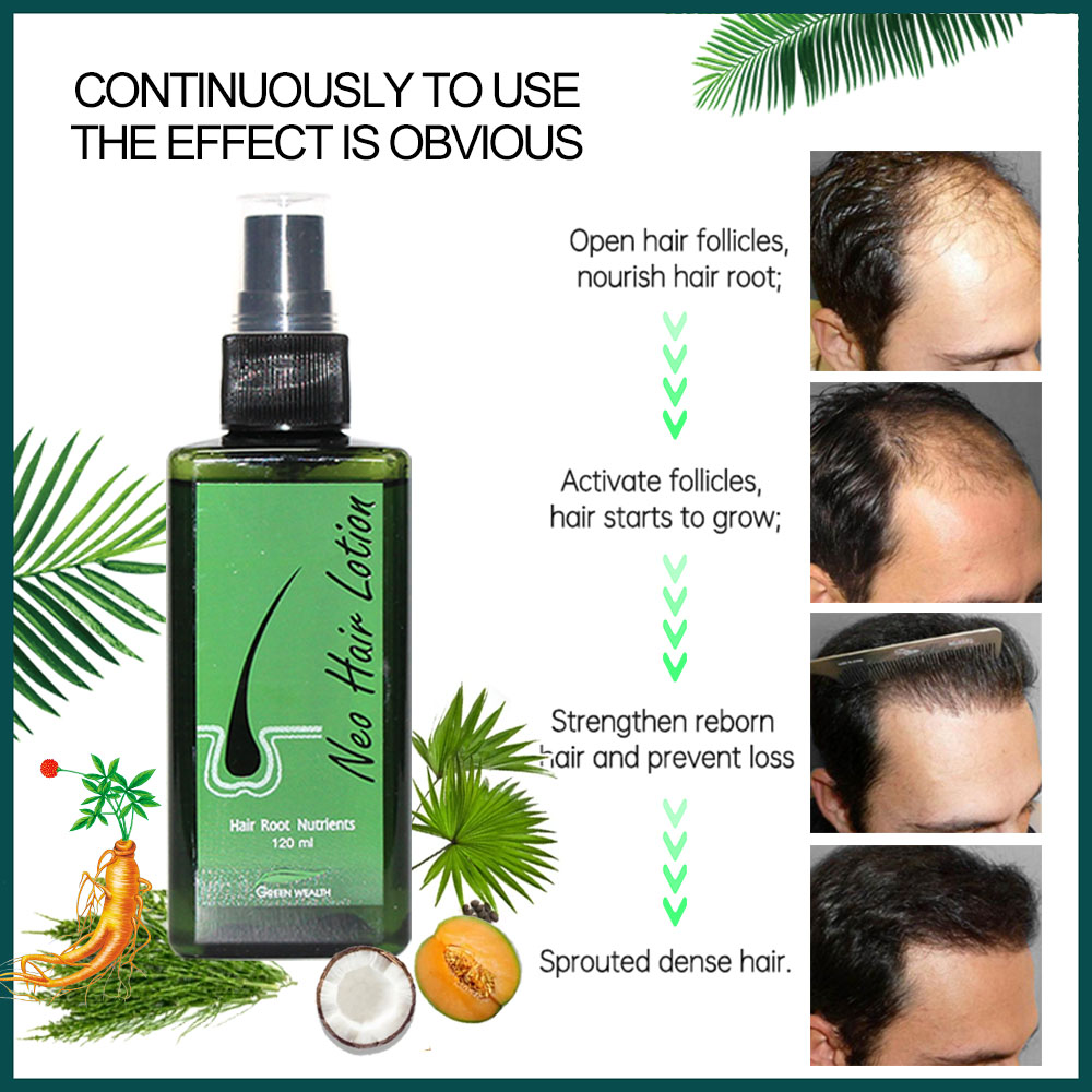 4 個ネオヘアローション 120 ミリリットルヘアケア毛根栄 - Biotin Hair Growth のレビューと価格